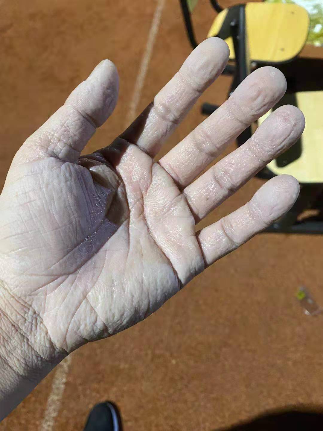 心疼！90后温江医务人员的手
