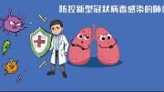 防控新型冠状病毒感染的肺炎