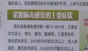 诺如病毒“余威”尚存  谨防孩子中招